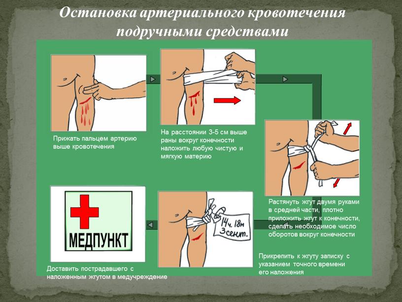 Остановка артериального кровотечения подручными средствами