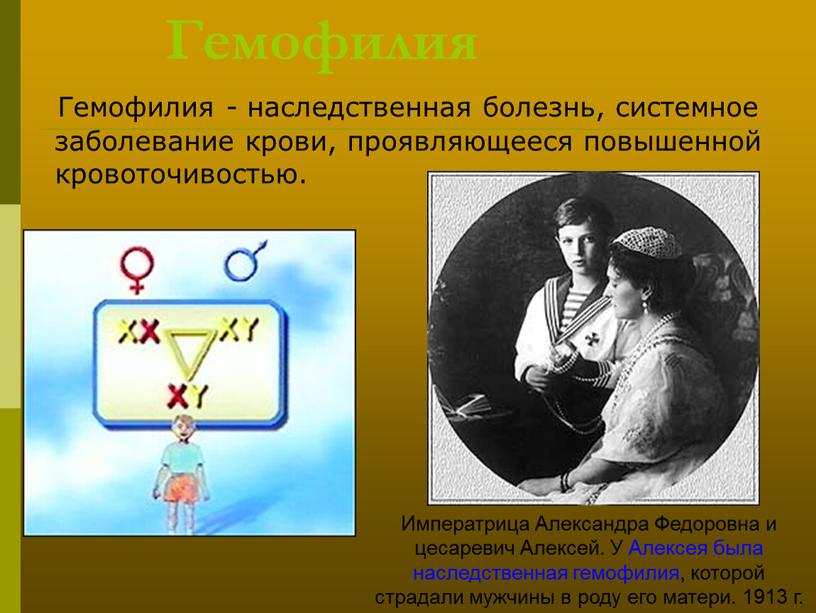 Гемофилия Гемофилия - наследственная болезнь, системное заболевание крови, проявляющееся повышенной кровоточивостью