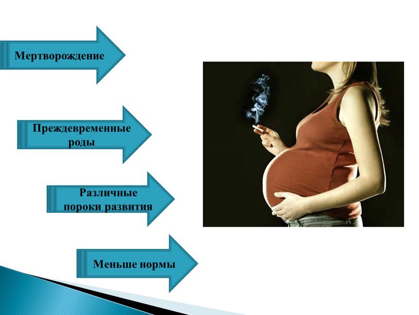 Мертворождение Преждевременные роды