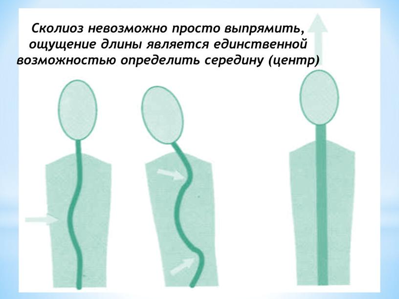 Сколиоз невозможно просто выпрямить, ощущение длины является единственной возможностью определить середину (центр)