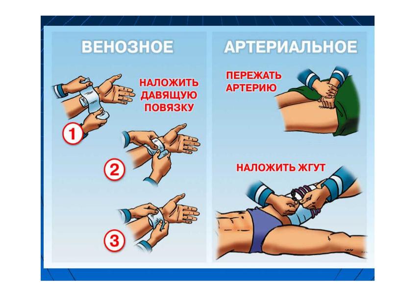 Доврачебная помощь пострадавшим с кровотечениями, геморрагическим шоком и коматозными состояниями