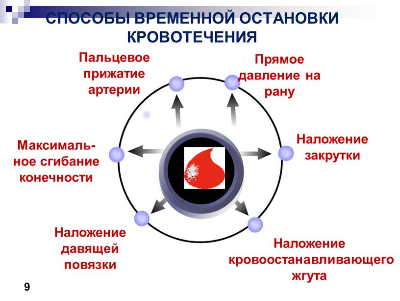 СПОСОБЫ ВРЕМЕННОЙ ОСТАНОВКИ КРОВОТЕЧЕНИЯ