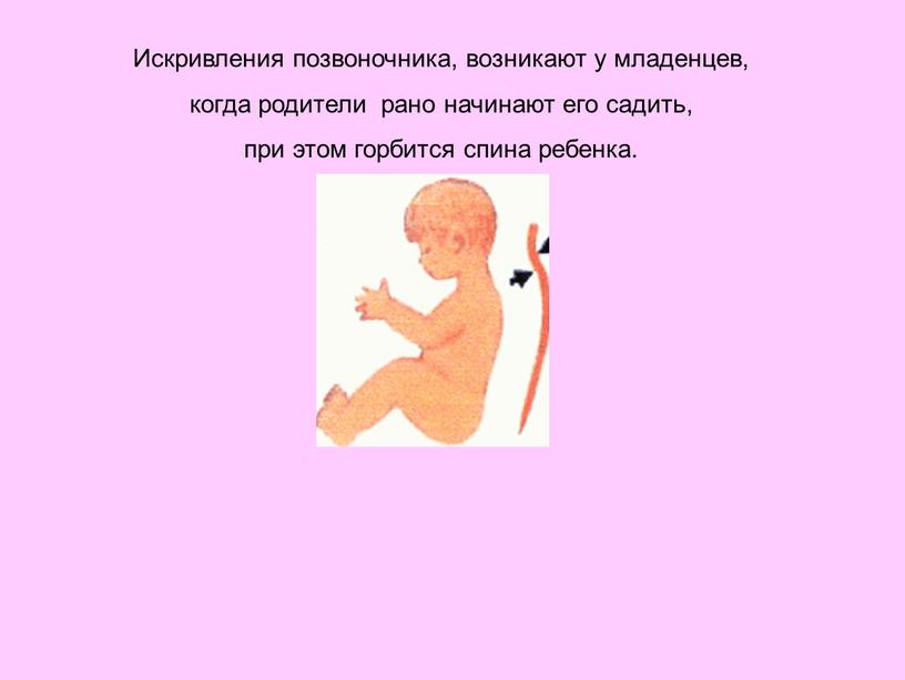 Искривления позвоночника, возникают у младенцев, когда родители рано начинают его садить, при этом горбится спина ребенка