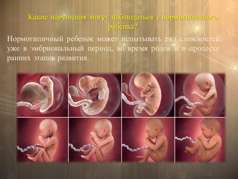 Нормотипичный ребенок может испытывать ряд сложностей уже в эмбриональный период, во время родов и в процессе ранних этапов развития