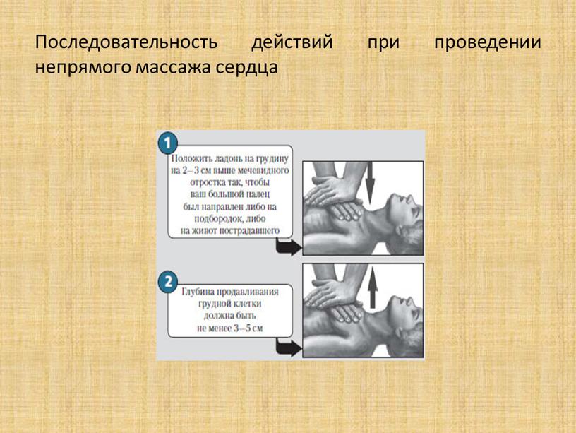 Последовательность действий при проведении непрямого массажа сердца