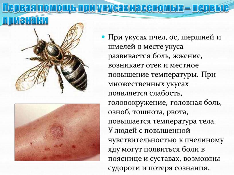 При укусах пчел, ос, шершней и шмелей в месте укуса развивается боль, жжение, возникает отек и местное повышение температуры