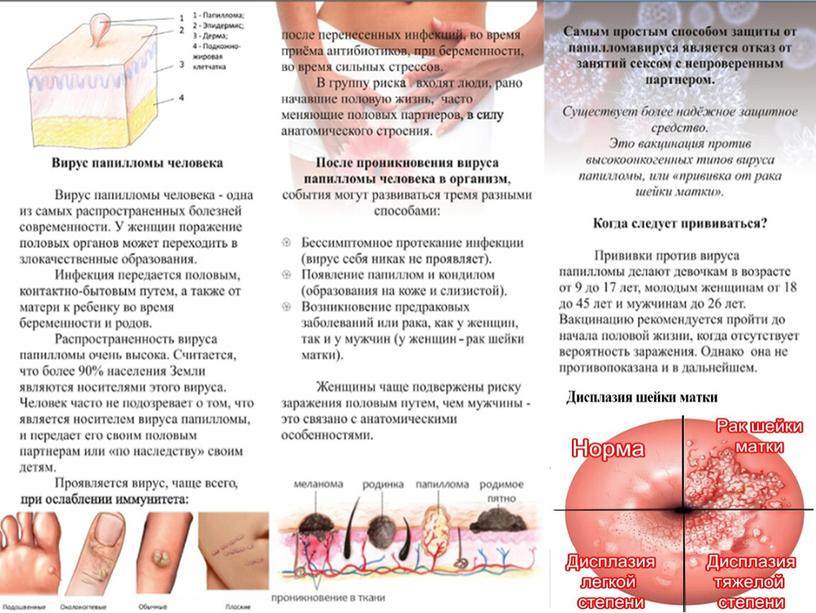 Профилактика вируса папилломы человека