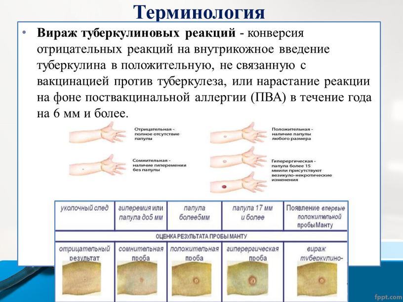 Терминология Вираж туберкулиновых реакций - конверсия отрицательных реакций на внутрикожное введение туберкулина в положительную, не связанную с вакцинацией против туберкулеза, или нарастание реакции на фоне…