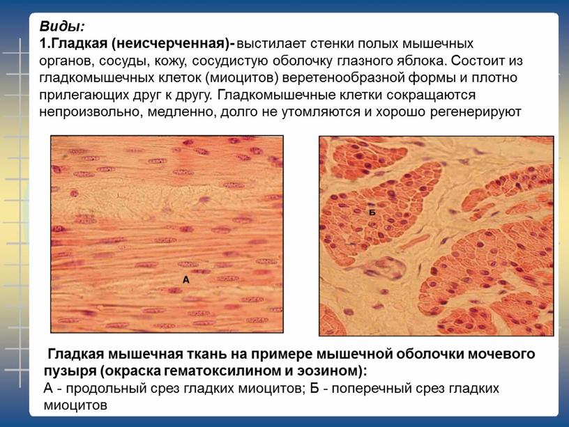 Гладкая мышечная ткань на примере мышечной оболочки мочевого пузыря (окраска гематоксилином и эозином):