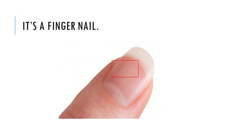 It’s a finger nail.