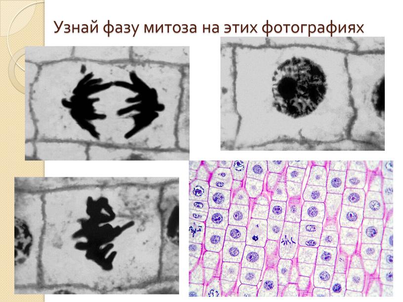 Узнай фазу митоза на этих фотографиях