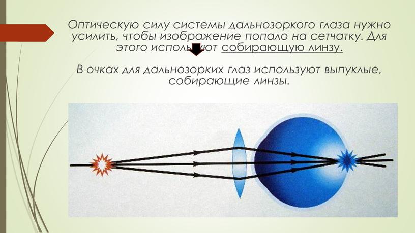 Оптическую силу системы дальнозоркого глаза нужно усилить, чтобы изображение попало на сетчатку