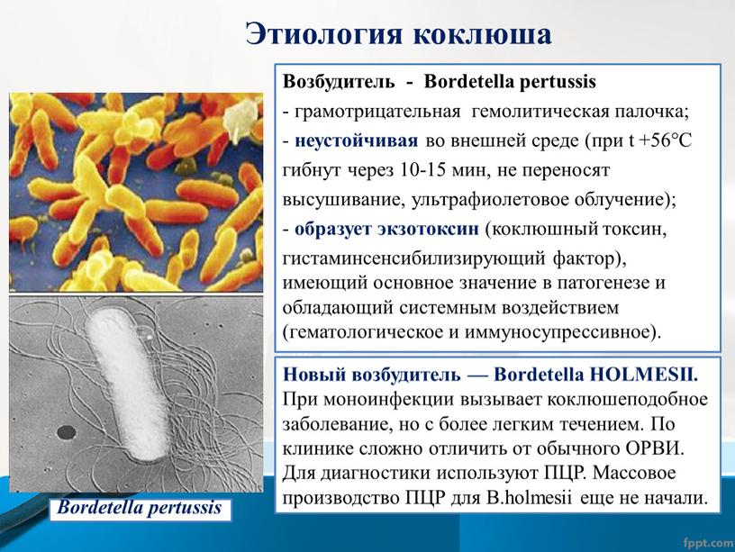 Этиология коклюша Возбудитель -