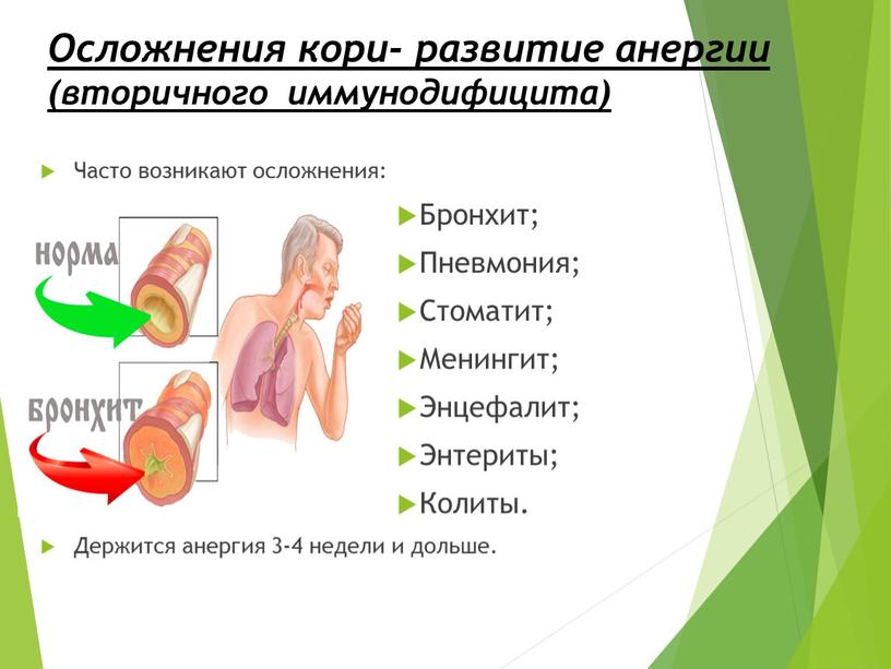 Осложнения кори- развитие анергии (вторичного иммунодифицита)