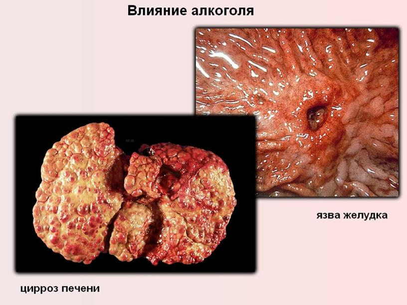 Гигиена пищеварения