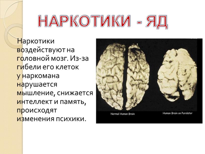 Наркотики воздействуют на головной мозг