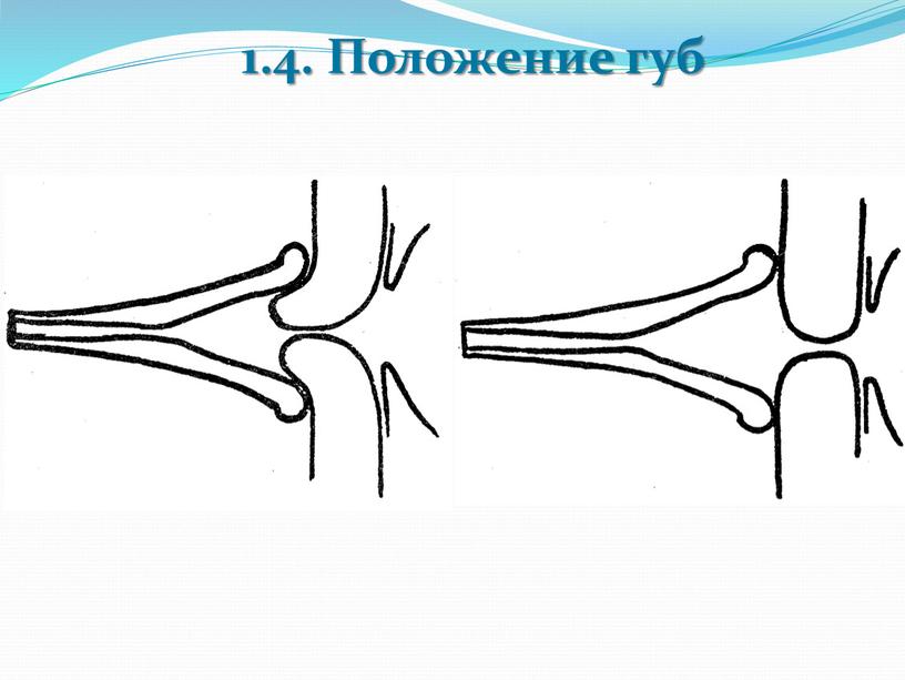 1.4. Положение губ