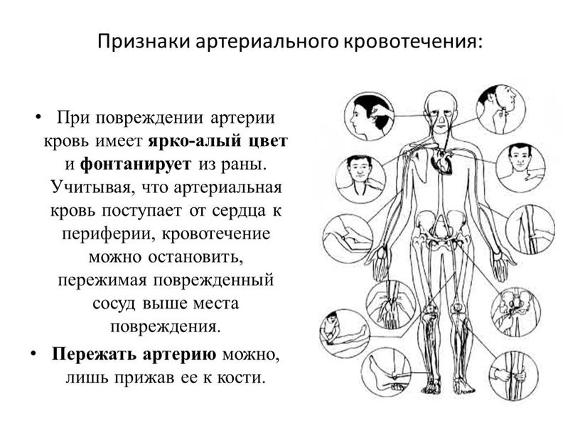 Признаки артериального кровотечения: