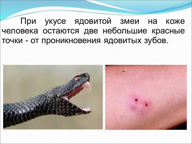 При укусе ядовитой змеи на коже человека остаются две небольшие красные точки - от проникновения ядовитых зубов