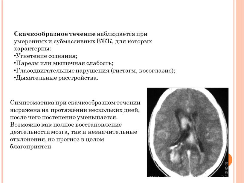 Скачкообразное течение наблюдается при умеренных и субмассивных