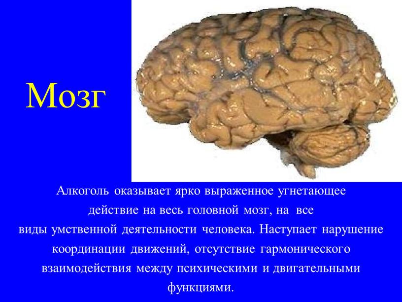 Мозг Алкоголь оказывает ярко выраженное угнетающее действие на весь головной мозг, на все виды умственной деятельности человека