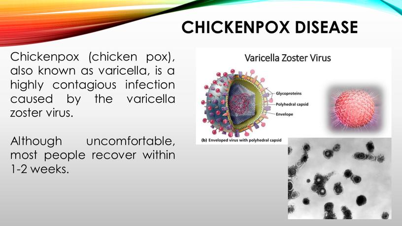 CHICKENPOX DISEASE Chickenpox (chicken pox), also known as varicella, is a highly contagious infection caused by the varicella zoster virus