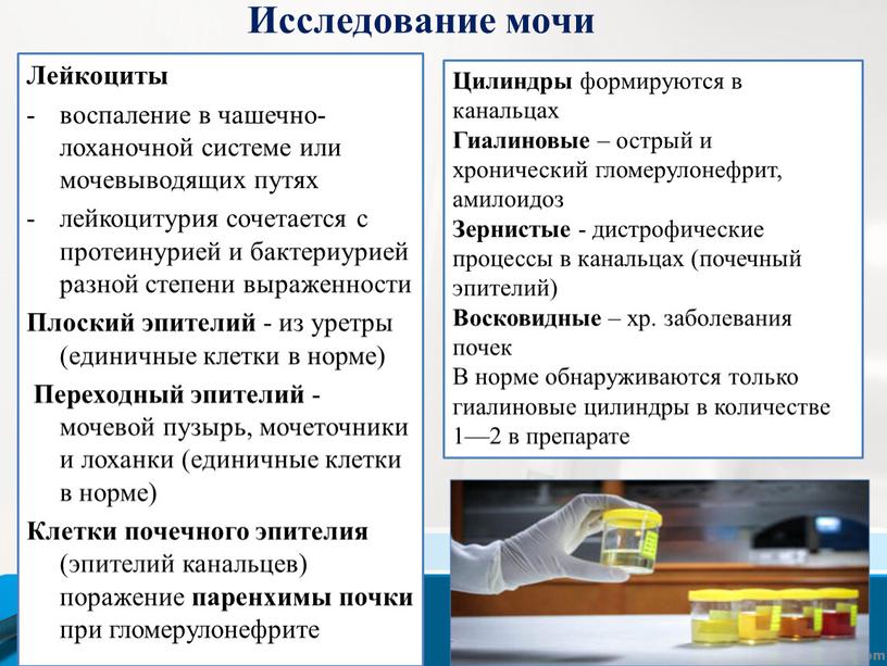 Лейкоциты воспаление в чашечно-лоханочной системе или мочевыводящих путях лейкоцитурия сочетается с протеинурией и бактериурией разной степени выраженности