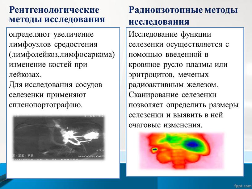 Рентгенологические методы исследования определяют увеличение лимфоузлов средостения (лимфолейкоз,лимфосаркома)изменение костей при лейкозах