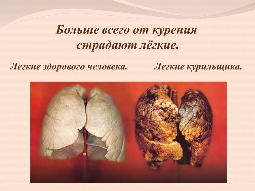 Больше всего от курения страдают лёгкие