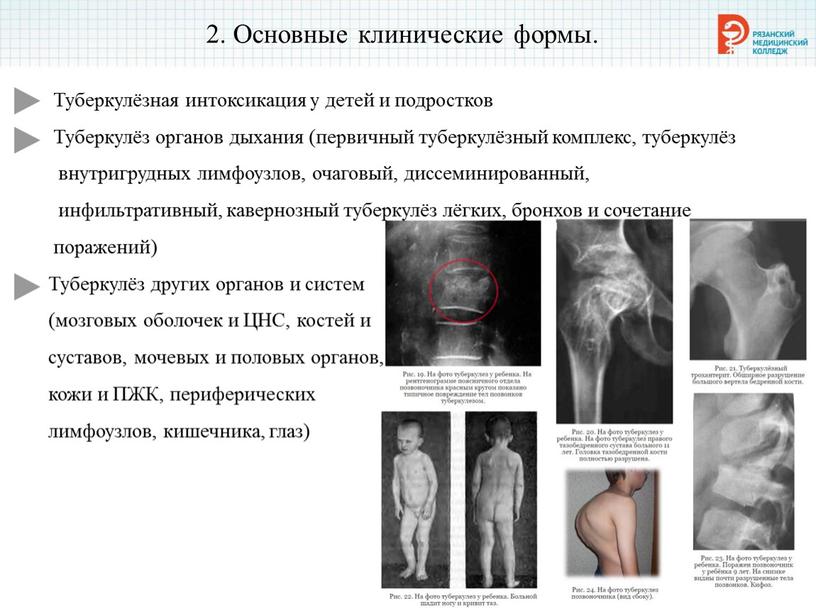 Основные клинические формы.