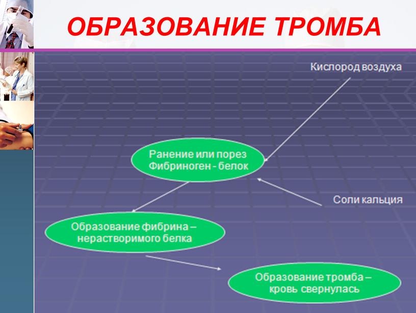 ОБРАЗОВАНИЕ ТРОМБА