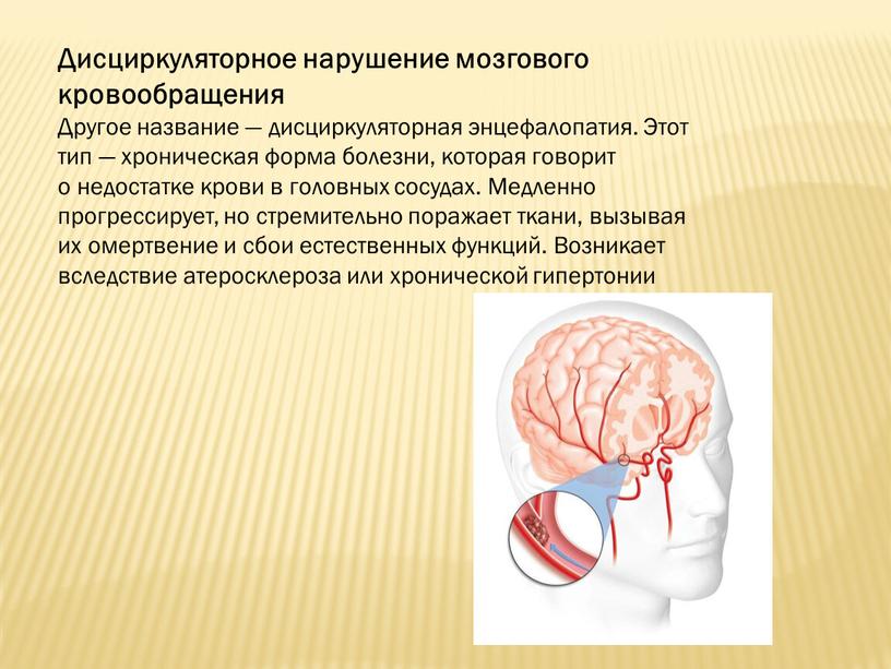 Дисциркуляторное нарушение мозгового кровообращения