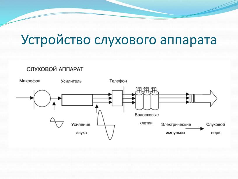 Устройство слухового аппарата