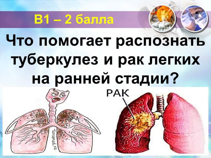 В1 – 2 балла Что помогает распознать туберкулез и рак легких на ранней стадии?