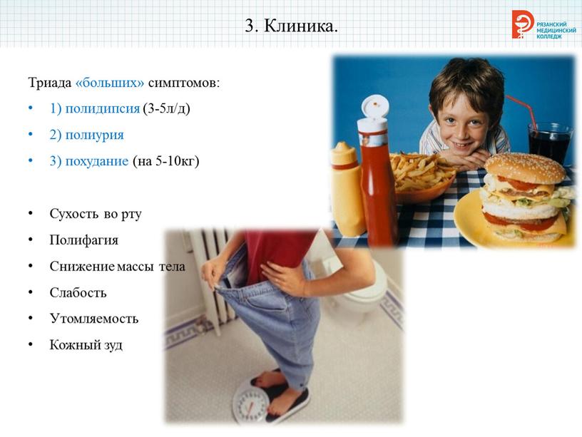 Клиника. Триада «больших» симптомов: 1) полидипсия (3-5л/д) 2) полиурия 3) похудание (на 5-10кг)