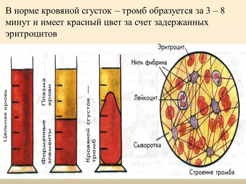 В норме кровяной сгусток – тромб образуется за 3 – 8 минут и имеет красный цвет за счет задержанных эритроцитов