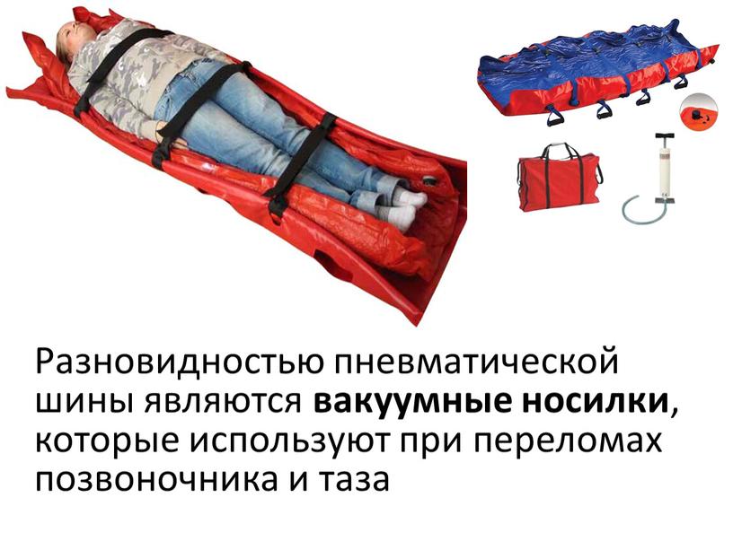 Разновидностью пневматической шины являются вакуумные носилки , которые используют при переломах позвоночника и таза