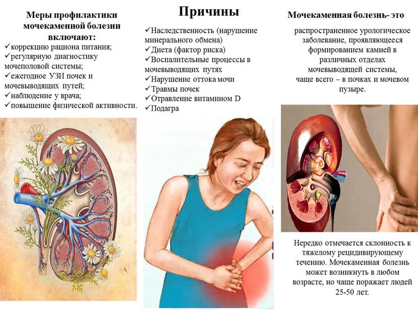 Мочекаменная болезнь- это распространенное урологическое заболевание, проявляющееся формированием камней в различных отделах мочевыводящей системы, чаще всего – в почках и мочевом пузыре