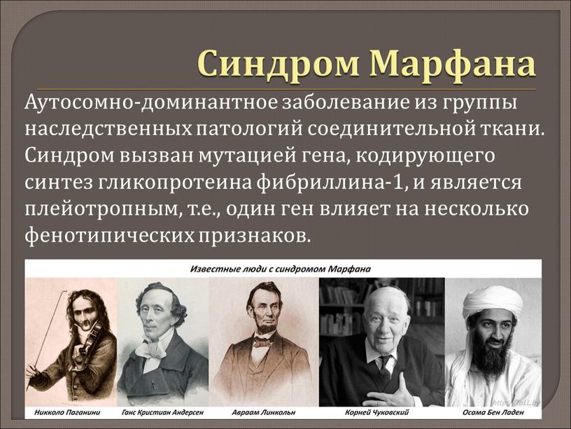 Синдром Марфана Аутосомно-доминантное заболевание из группы наследственных патологий соединительной ткани