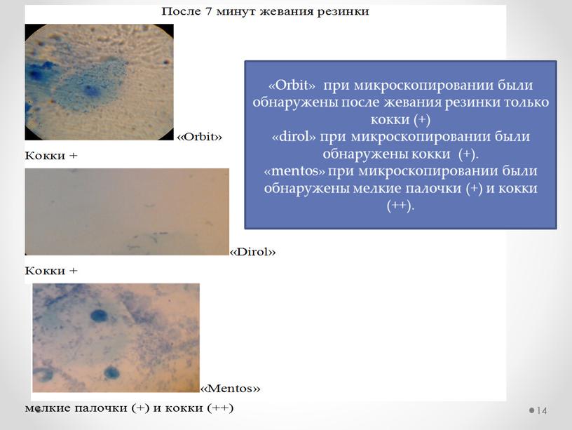 Orbit» при микроскопировании были обнаружены после жевания резинки только кокки (+) «dirol» при микроскопировании были обнаружены кокки (+)