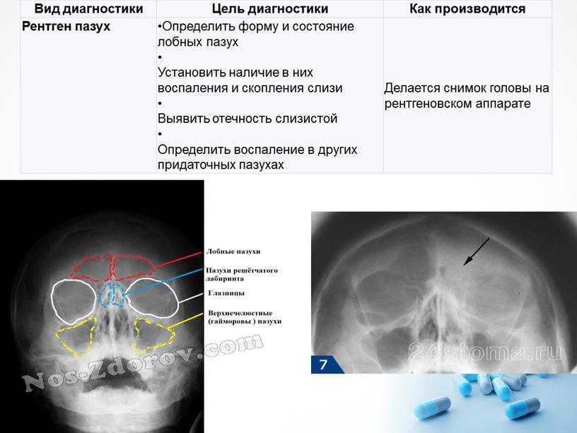 Вид диагностики Цель диагностики