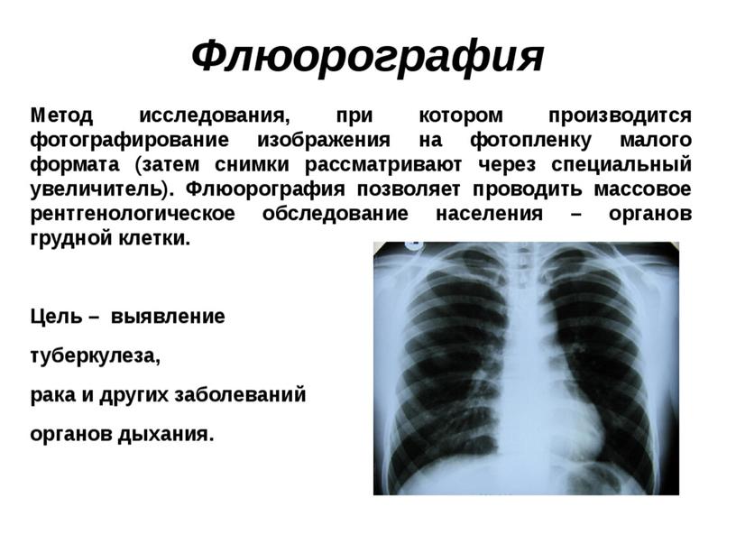 Разработка урока "Жизненная емкость легких.Реанимация."