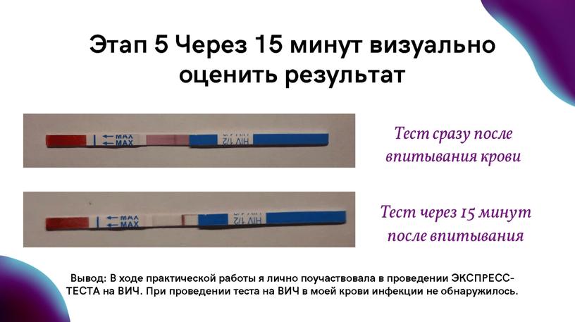 Исследовательская работа по теме  "Проблема распространения ВИЧ - инфекции"