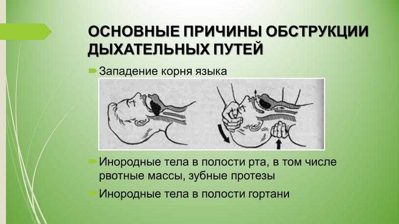 ОСНОВНЫЕ ПРИЧИНЫ ОБСТРУКЦИИ ДЫХАТЕЛЬНЫХ