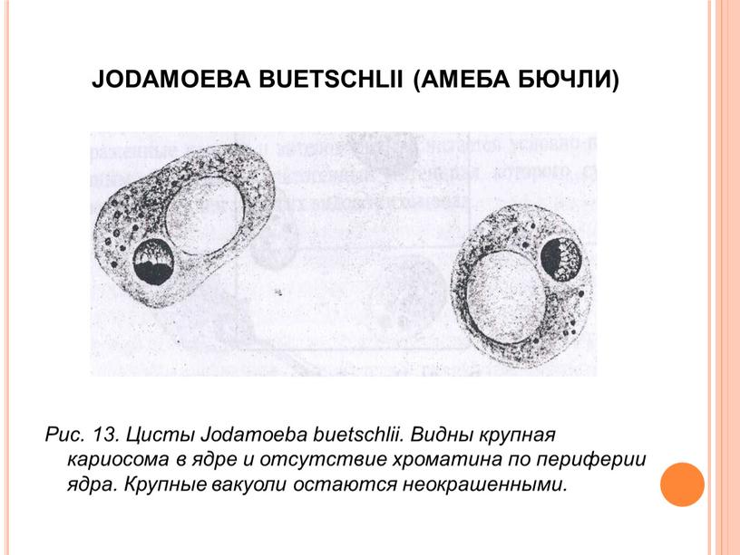 JODAMOEBA BUETSCHLII (АМЕБА БЮЧЛИ)