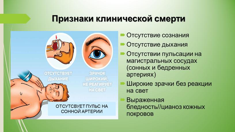 Признаки клинической смерти Отсутствие сознания