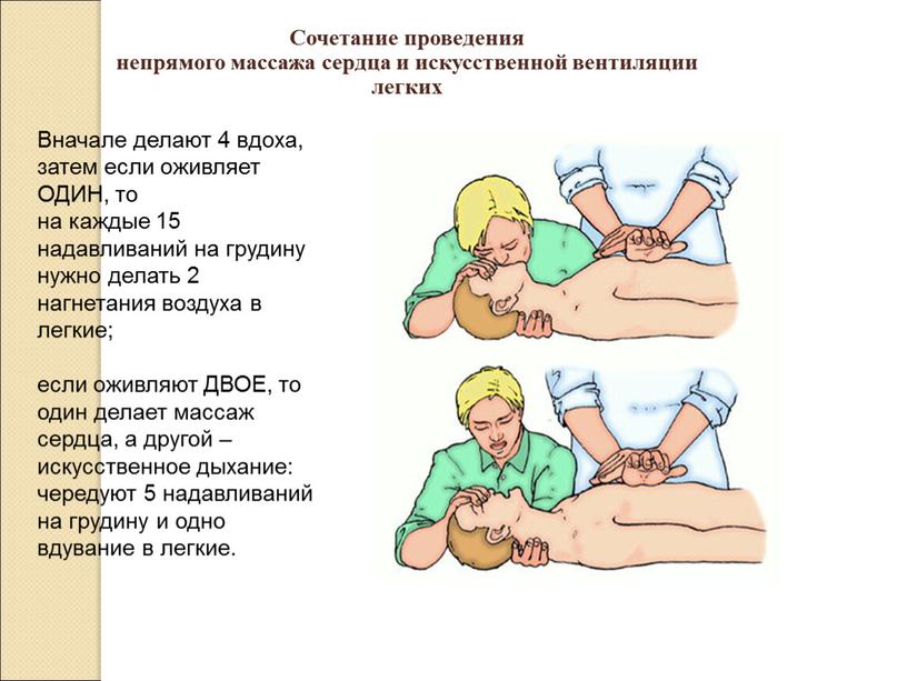 Сочетание проведения непрямого массажа сердца и искусственной вентиляции легких