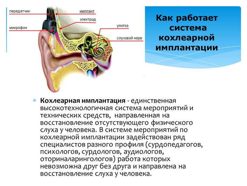 Кохлеарная имплантация - единственная высокотехнологичная система мероприятий и технических средств, направленная на восстановление отсутствующего физического слуха у человека