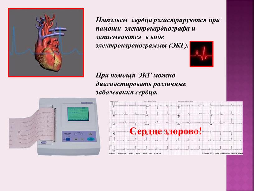 Импульсы сердца регистрируются при помощи электрокардиографа и записываются в виде электрокардиограммы (ЭКГ)