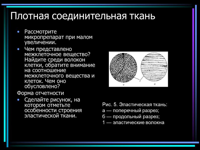 Плотная соединительная ткань Рассмотрите микропрепарат при малом увеличении